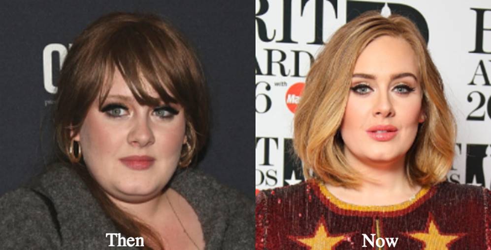 Adele Before and After