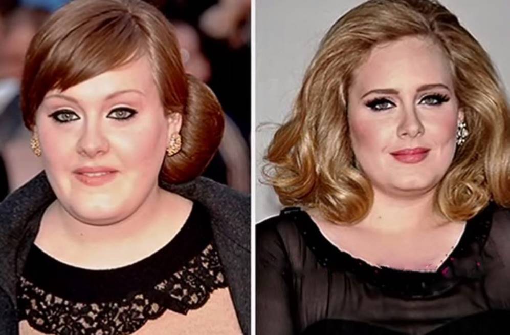 Adele Before and After