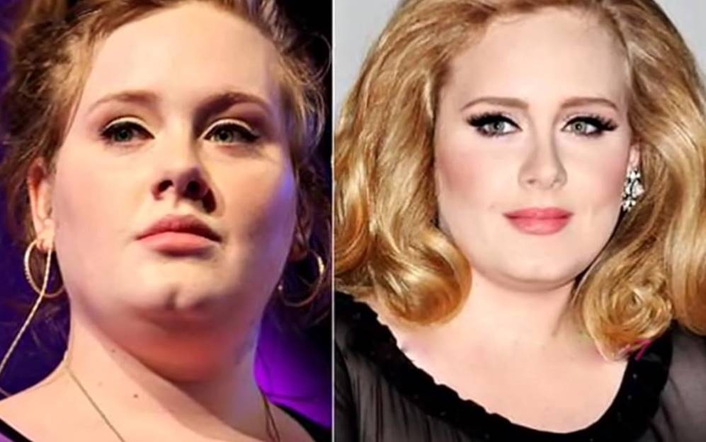 Adele Before and After