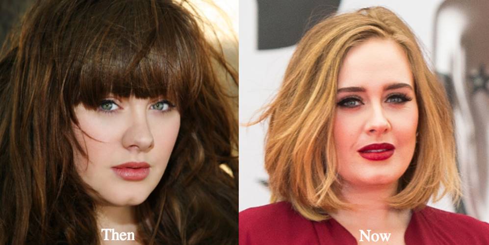 Adele Before and After