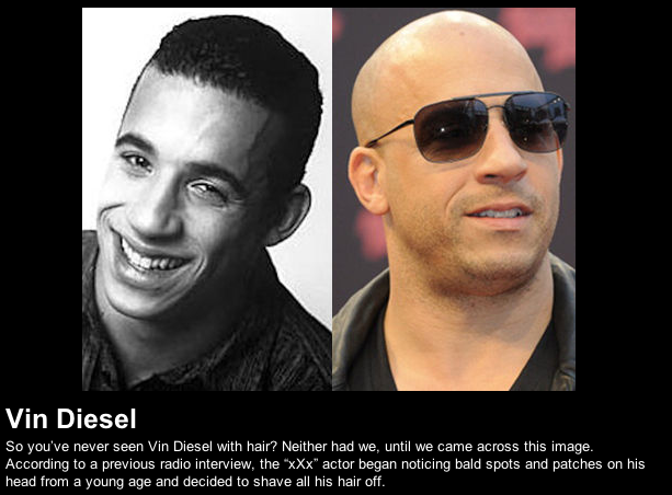 Vin Diesel’s Hair